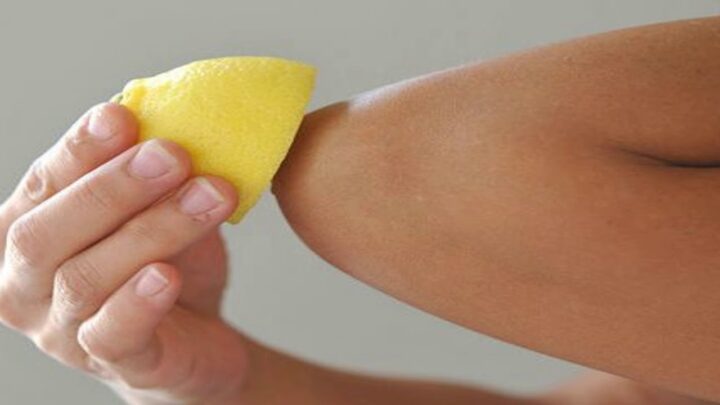 protiraem-lokti-limonom.jpg