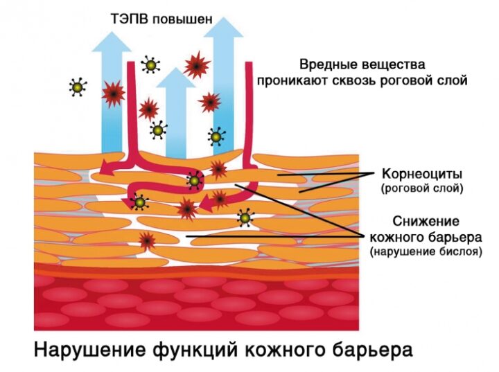 narushenie-kozhnogo-bar'era.jpg