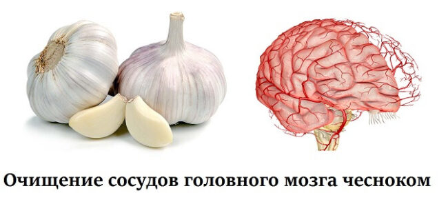 chesnok.jpg